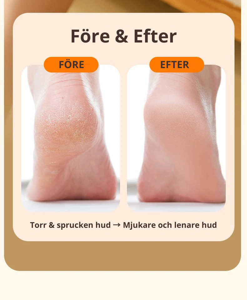 Elektrisk Fotfil med LED-ljus